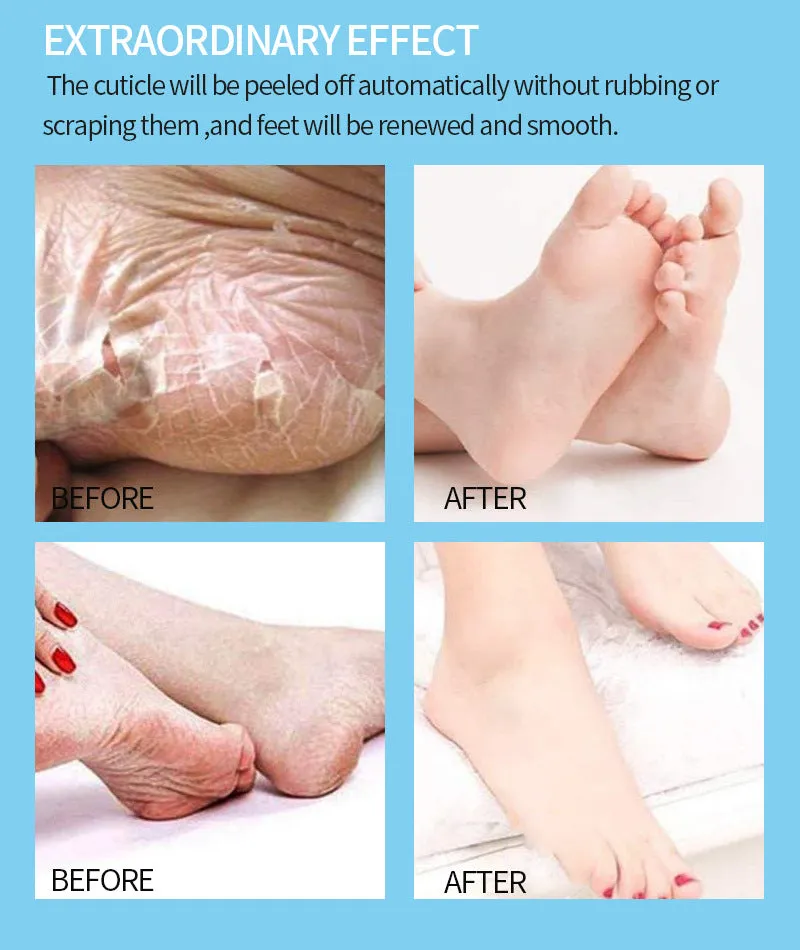 Lavender Olive Foot Mask Calluses Dead Skin Horny Foot Mask Foot Cover Lavender Olive Foot Mask Calluses Dead Skin Horny Foot Mask Foot Cover