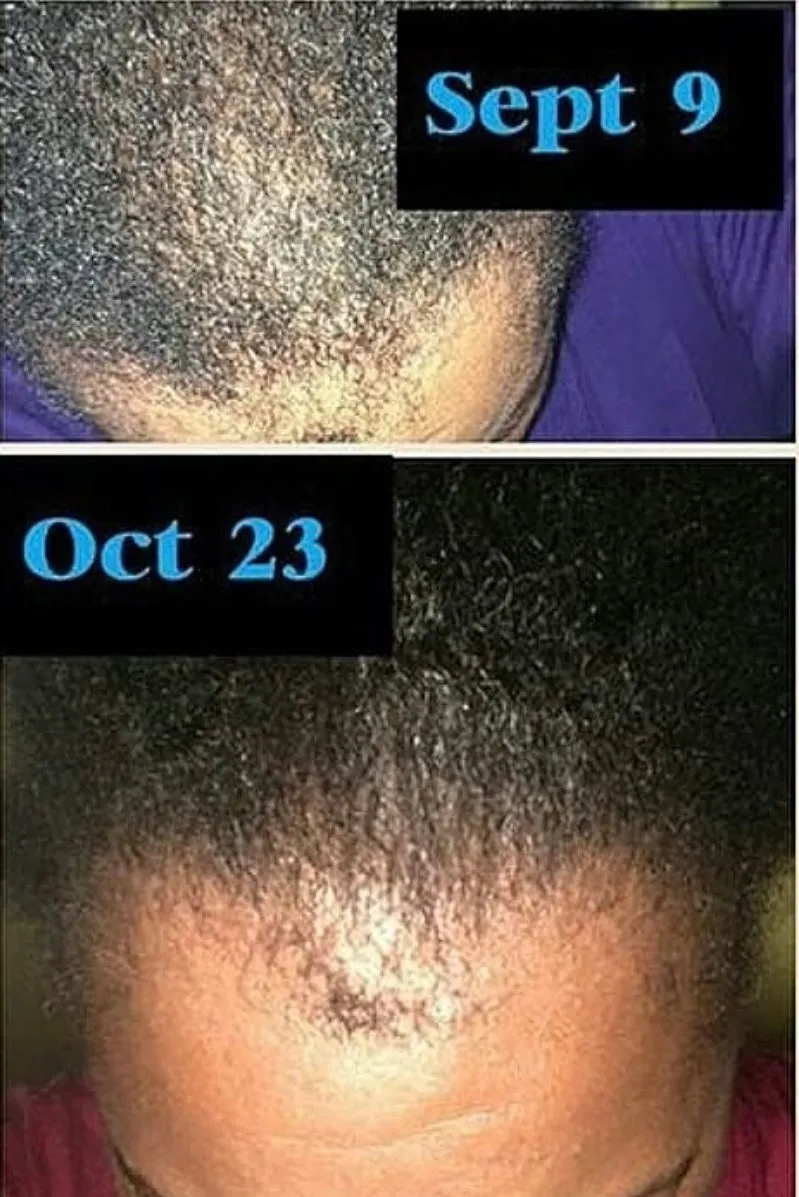MAGIC Hair Growth Serum