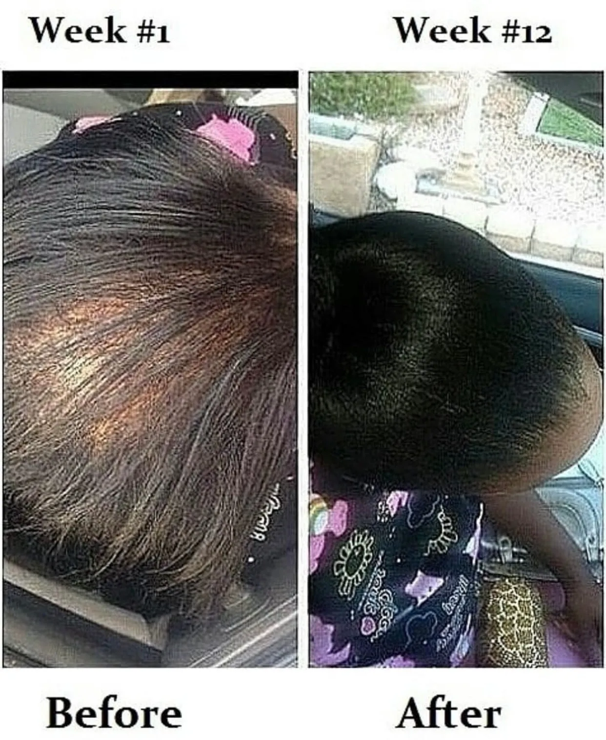 MAGIC Hair Growth Serum