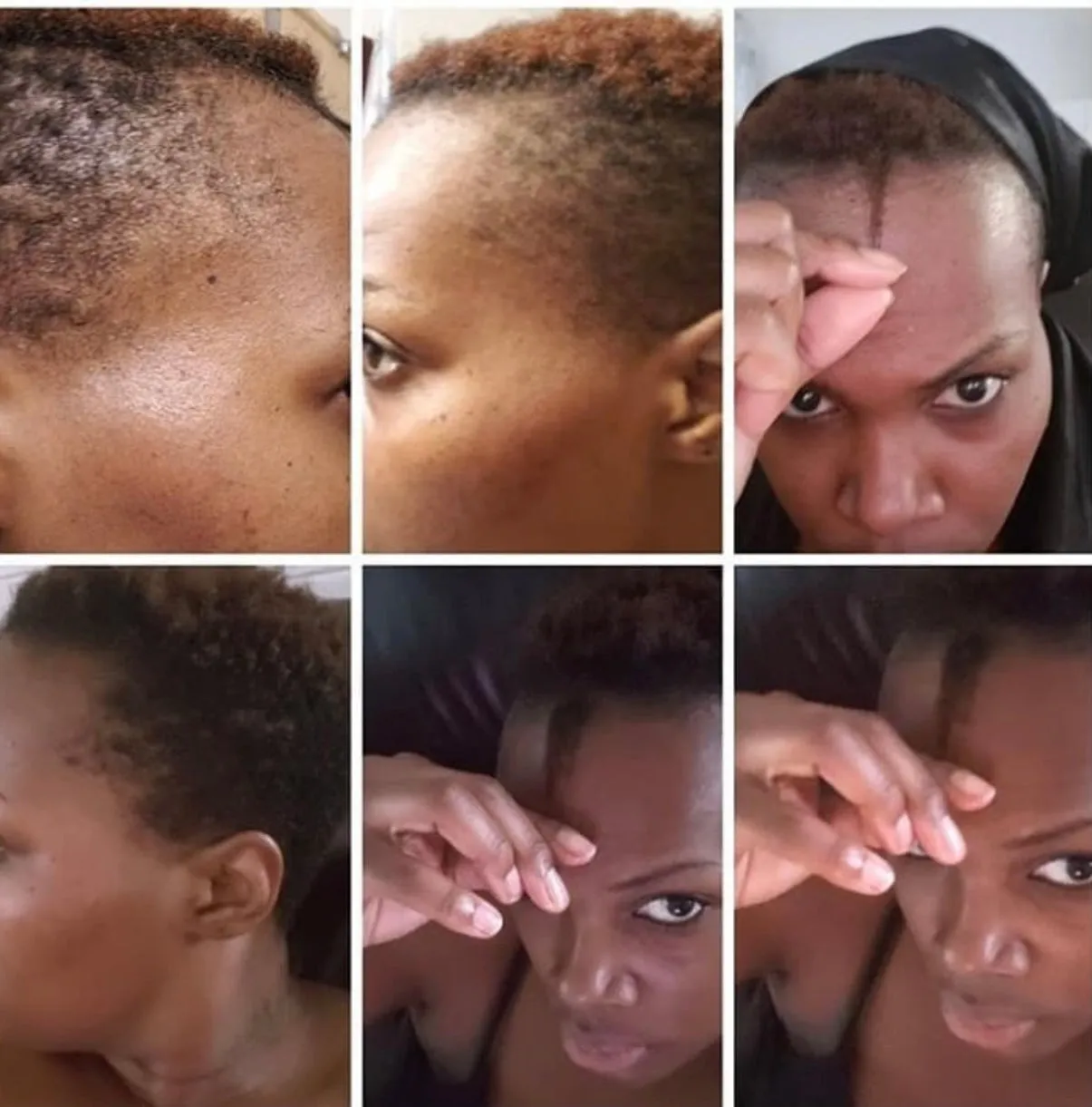 MAGIC Hair Growth Serum