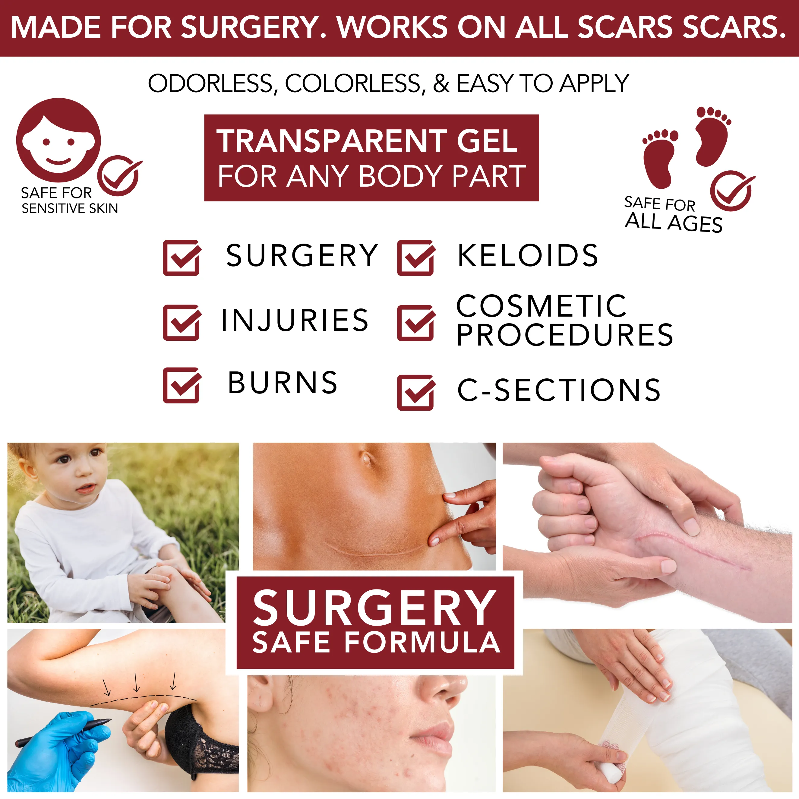 Medical-grade Silicone Scar Gel "Semi-Solid Sheeting"
