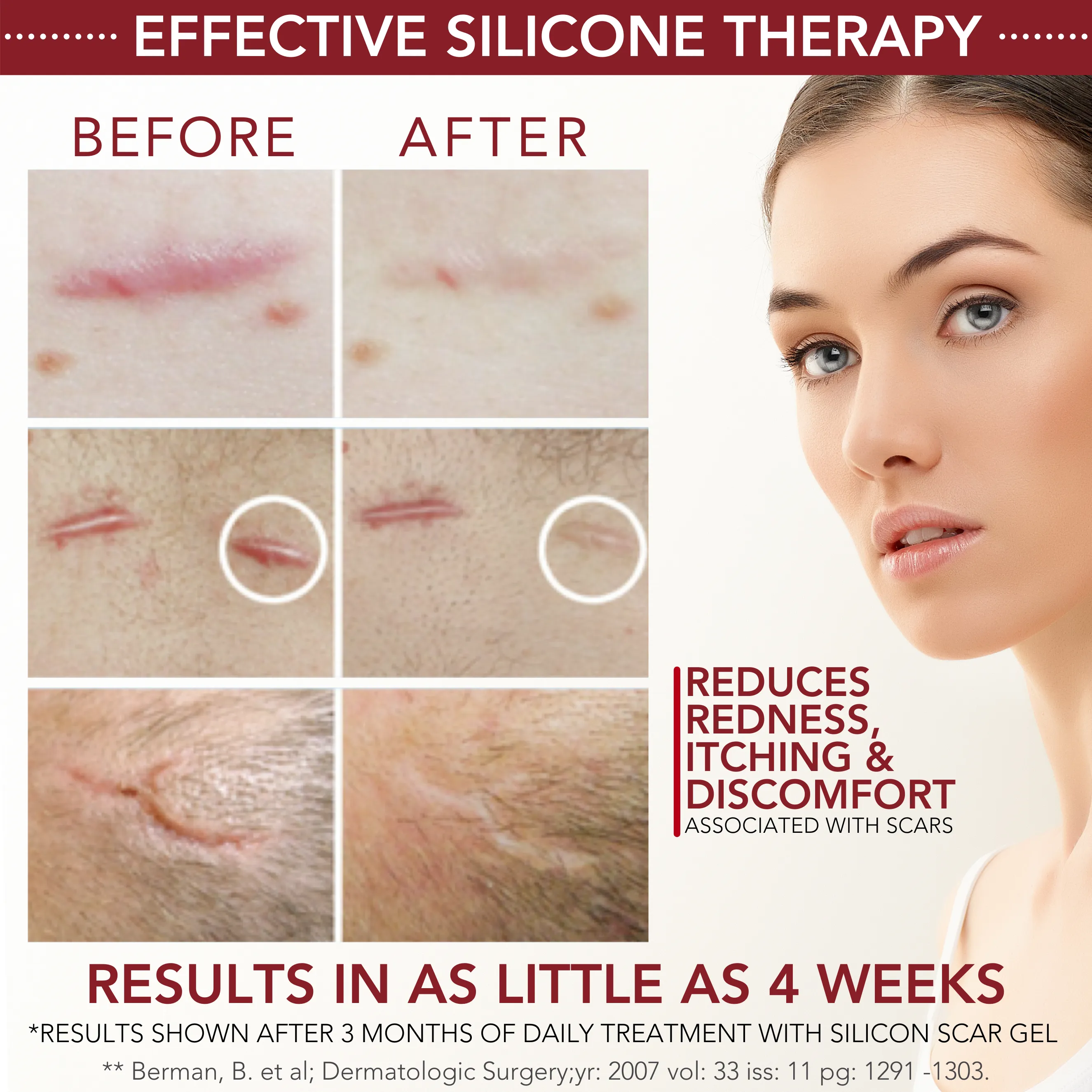 Medical-grade Silicone Scar Gel "Semi-Solid Sheeting"