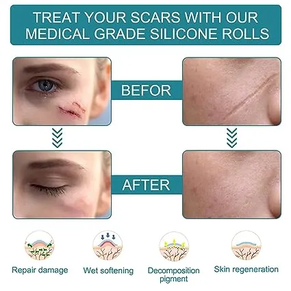Medical Grade Silicone Scar Sheets