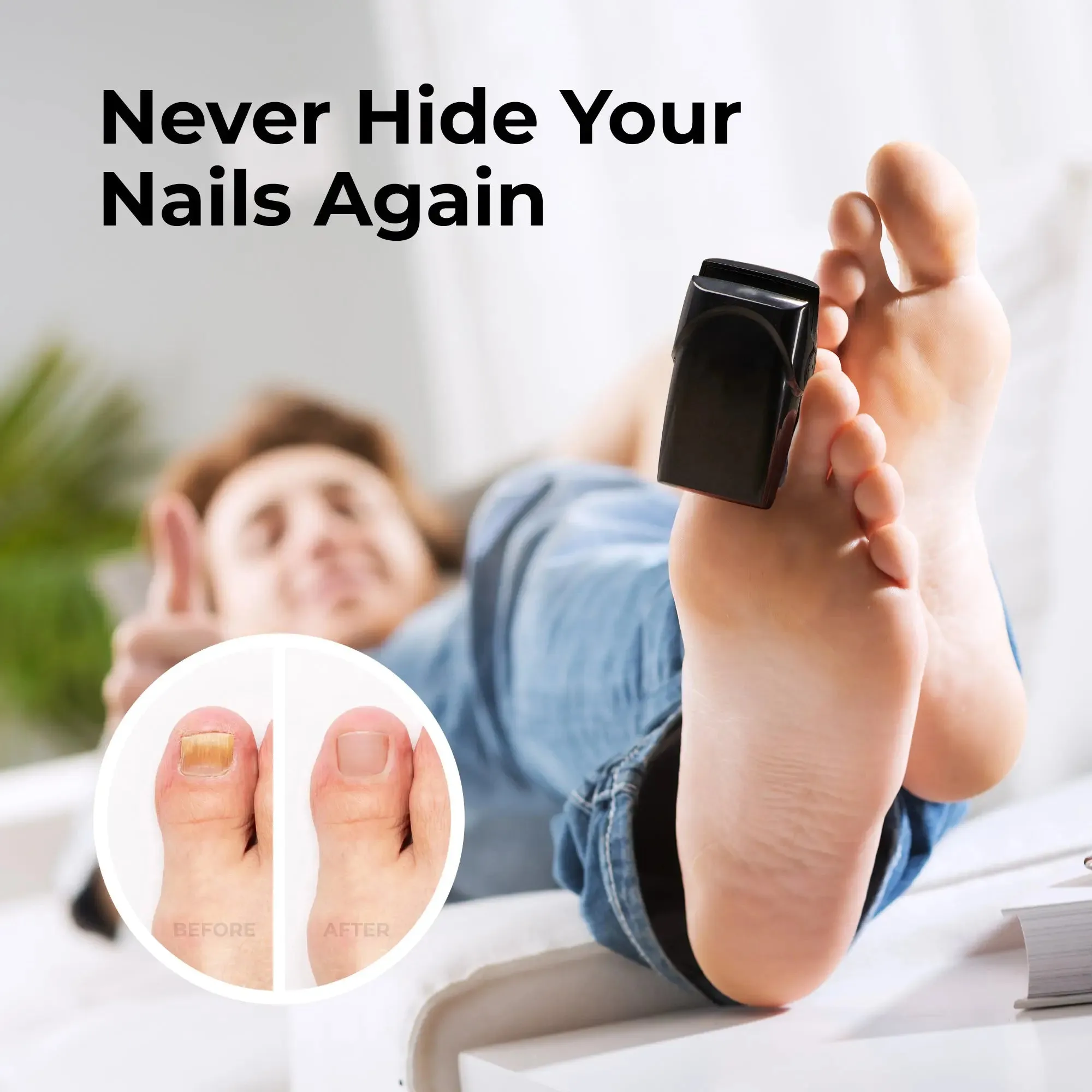 MicroRemedy™ Nail Fungus Light Therapy Device
