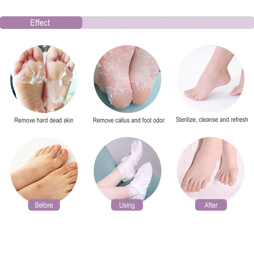 MOND' SUB 4 Pieces Lavender Peeling Foot Masks That Moisturize The Heels.