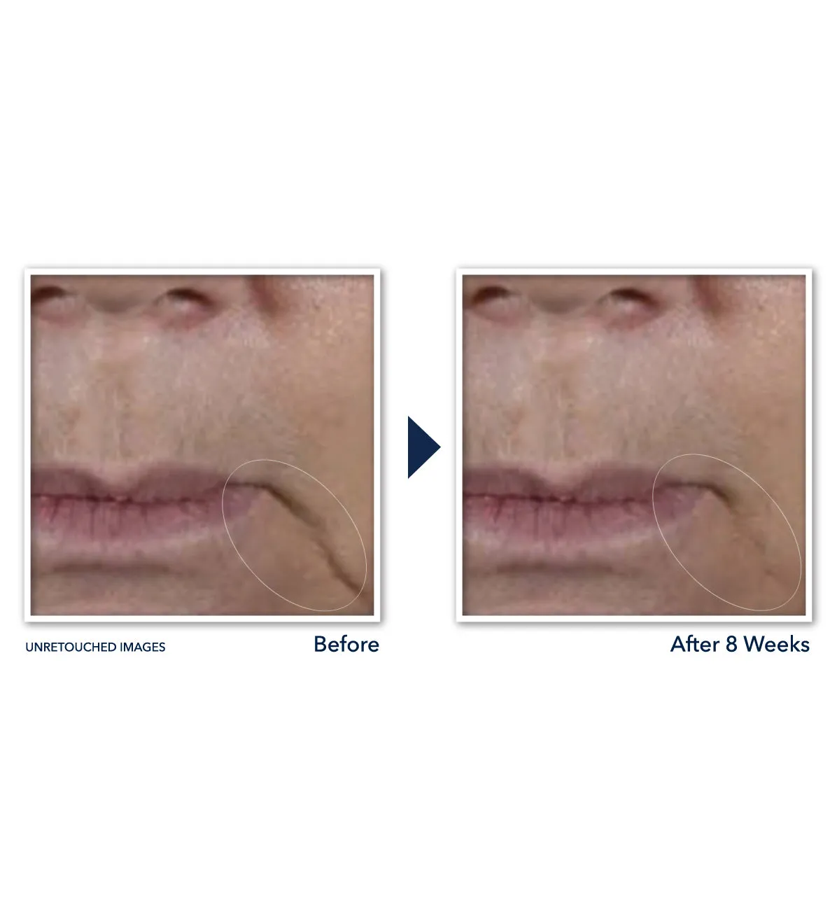 MULTI CORREXION® Firm   Lift Anti-Sagging Firming Cream