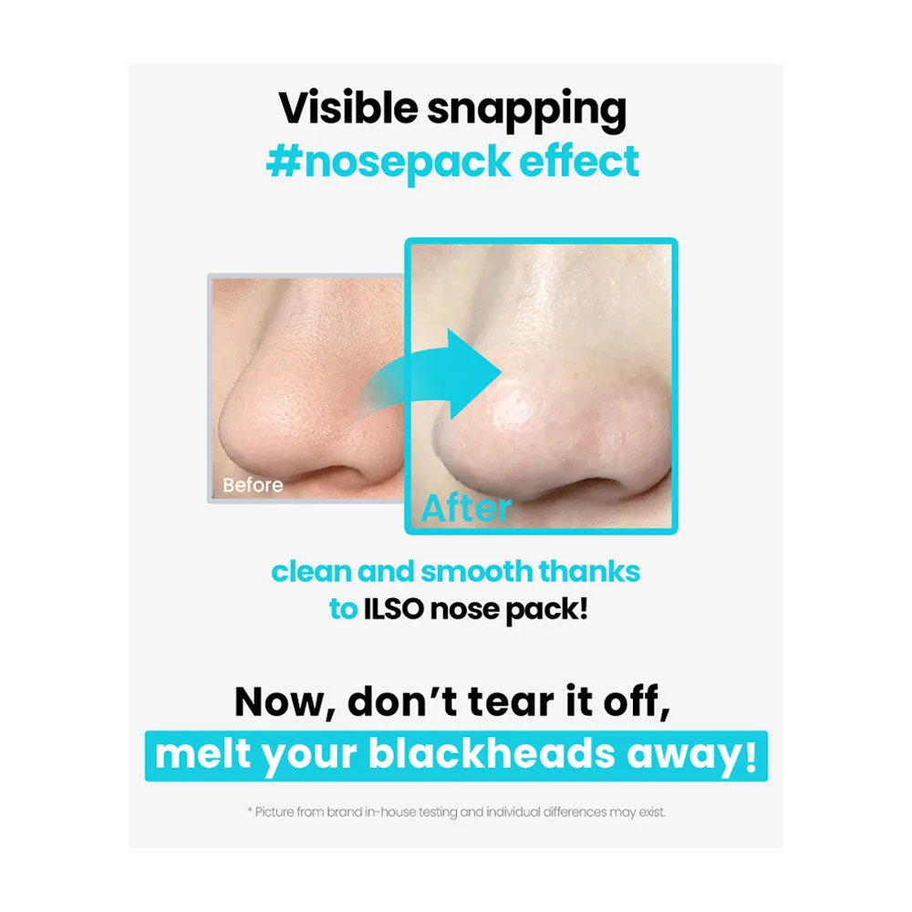 Natural Mild Clear Nose Pack