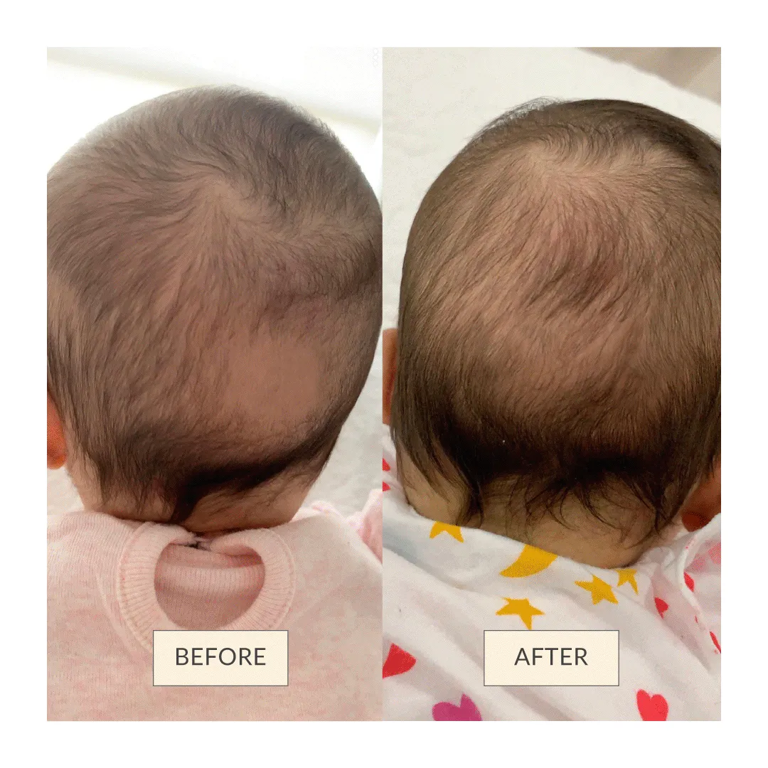 O’mumsie Baby Hair Growth & Scalp Care Oil