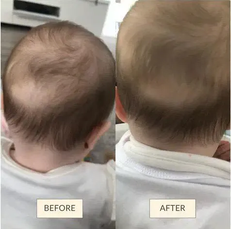O’mumsie Baby Hair Growth & Scalp Care Oil