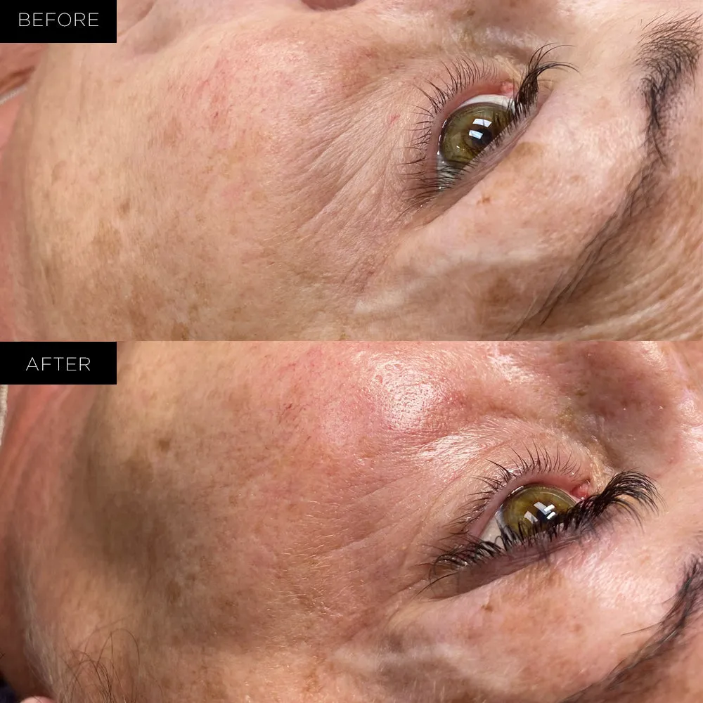 Organic Rejuvenating Formula Under Eye Therapy Gel Pads by Endure™ Beauty