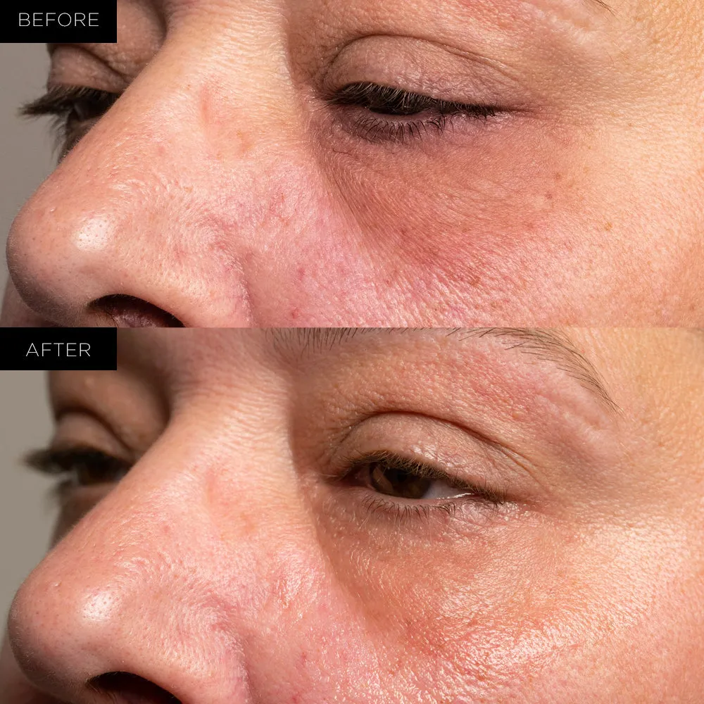 Organic Rejuvenating Formula Under Eye Therapy Gel Pads by Endure™ Beauty