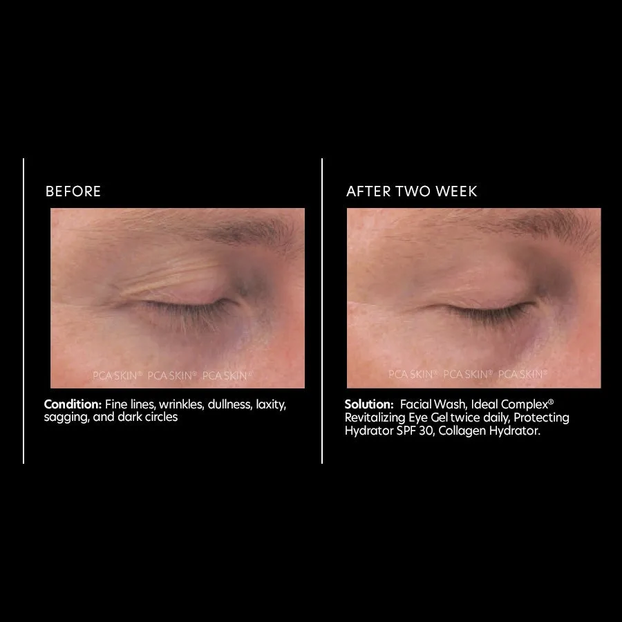 PCA Ideal Complex Revitalizing Eye Gel