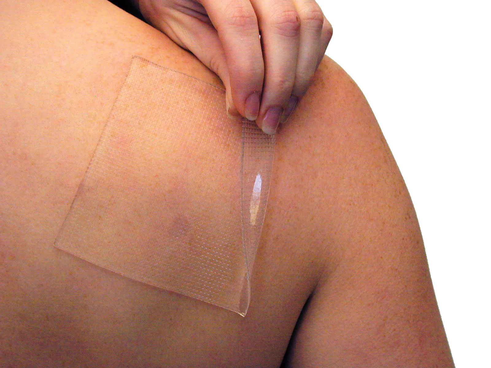 PEDIFIX SCAR MANAGEMENT SHEET