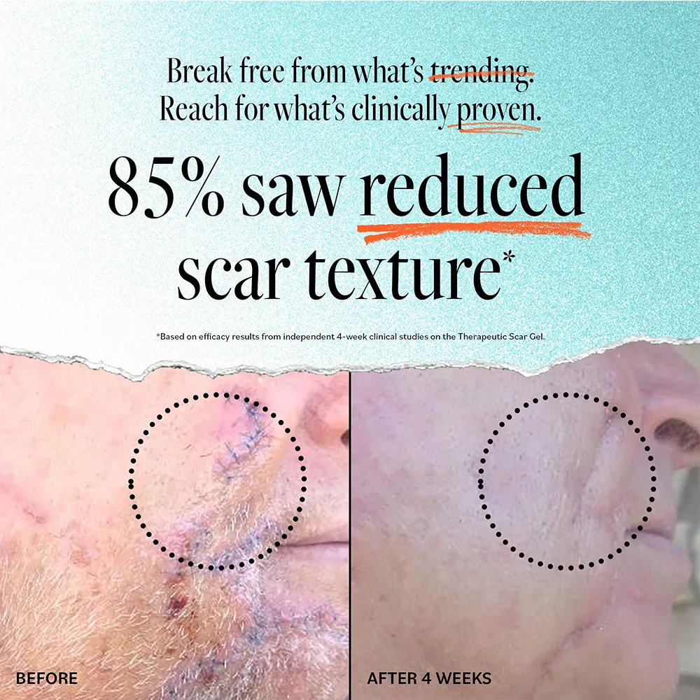Scar Gel
