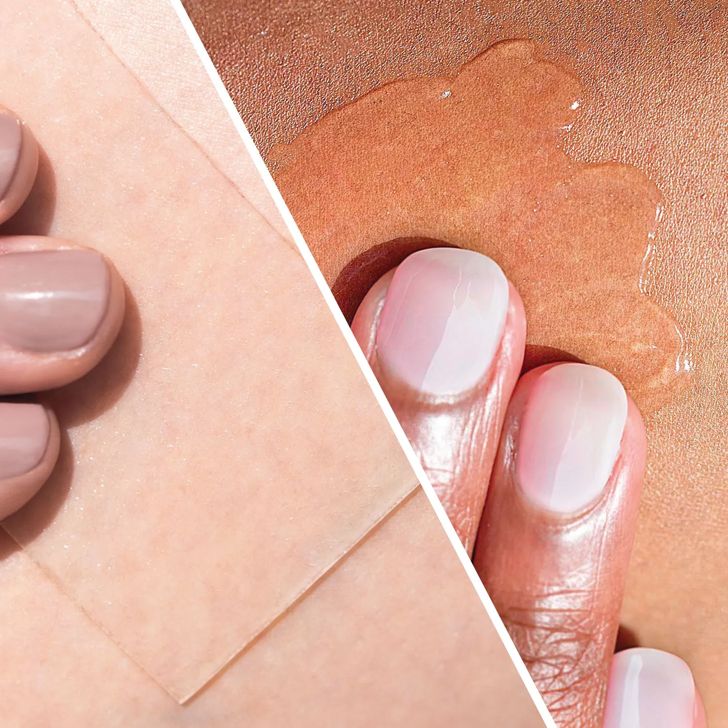 Scar Heal Kit - 1.5" X 3" Pair