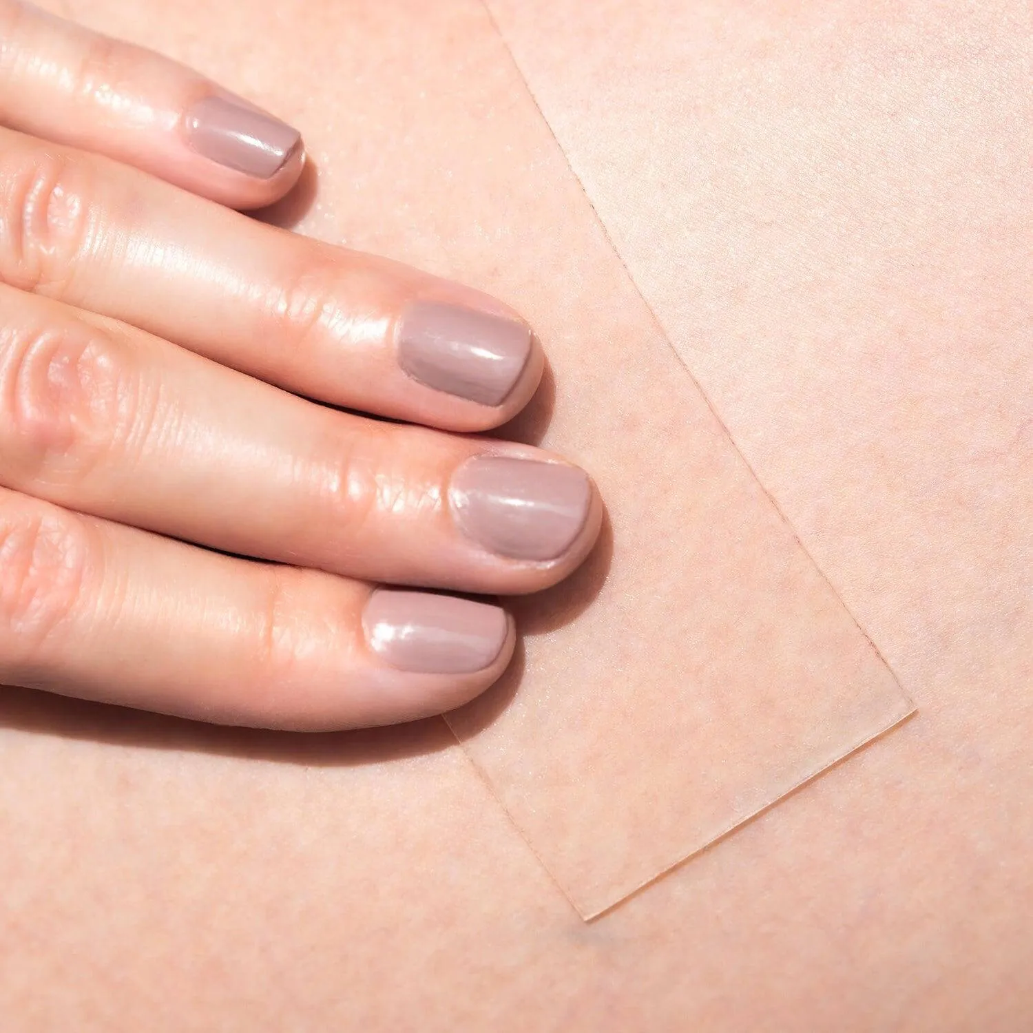 Scar Heal Kit Plus 3.75 x 7.5cm