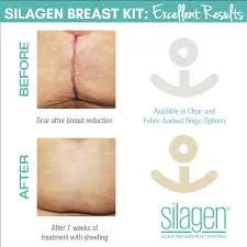 Silagen Breast Kit Clear