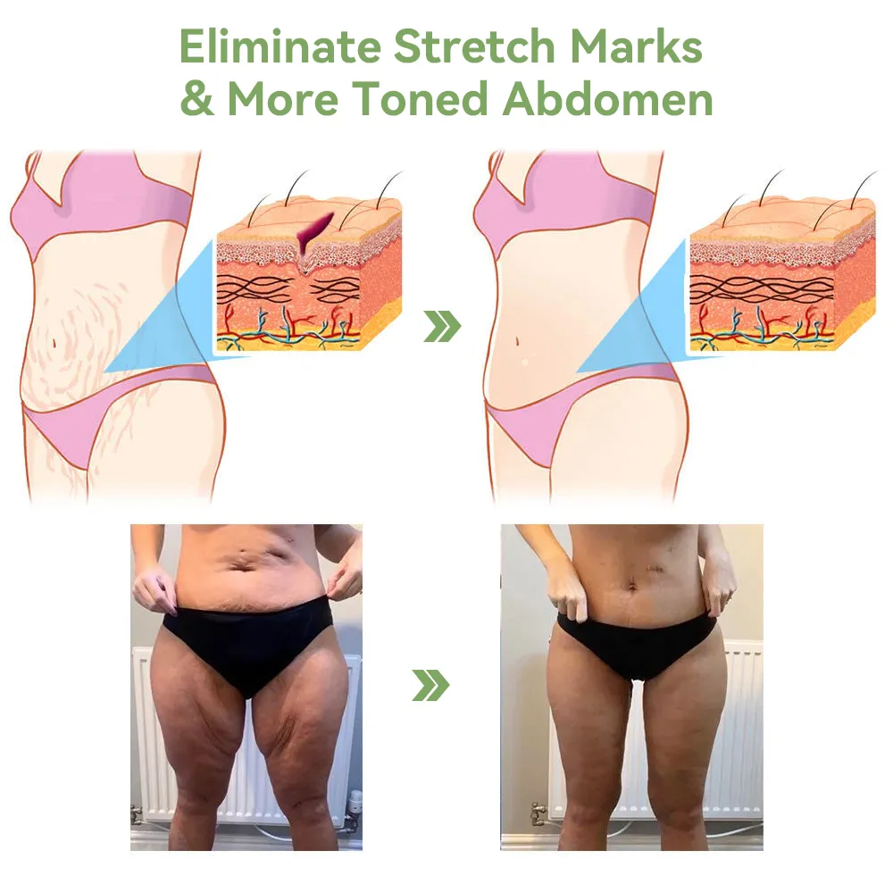 👩‍⚕️🔥STDEI™  𝑳𝒖𝒙𝒖𝒓𝒊𝒐𝒖𝒔 𝑪𝒐𝒍𝒍𝒂𝒈𝒆𝒏 𝑭𝒊𝒓𝒎𝒊𝒏𝒈 𝑪𝒓𝒆𝒂𝒎(🔥70% Off for a Limited Time!)🎉