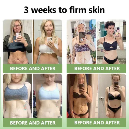👩‍⚕️🔥STDEI™  𝑳𝒖𝒙𝒖𝒓𝒊𝒐𝒖𝒔 𝑪𝒐𝒍𝒍𝒂𝒈𝒆𝒏 𝑭𝒊𝒓𝒎𝒊𝒏𝒈 𝑪𝒓𝒆𝒂𝒎(🔥70% Off for a Limited Time!)🎉