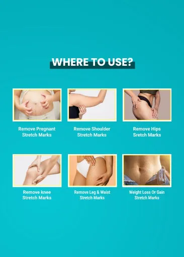 Stretch Mark Removal Oil