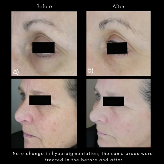 The Advanced Response Complex™ Face   Neck Cream