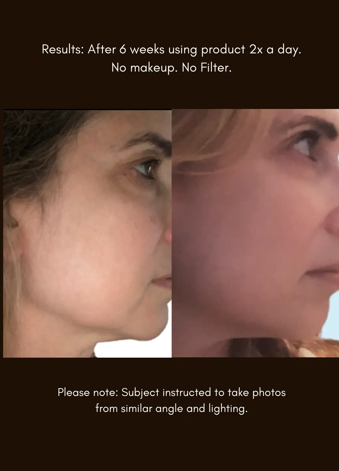 The Advanced Response Complex™ Face   Neck Cream