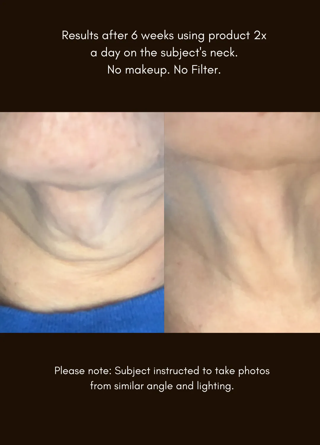 The Advanced Response Complex™ Face   Neck Cream