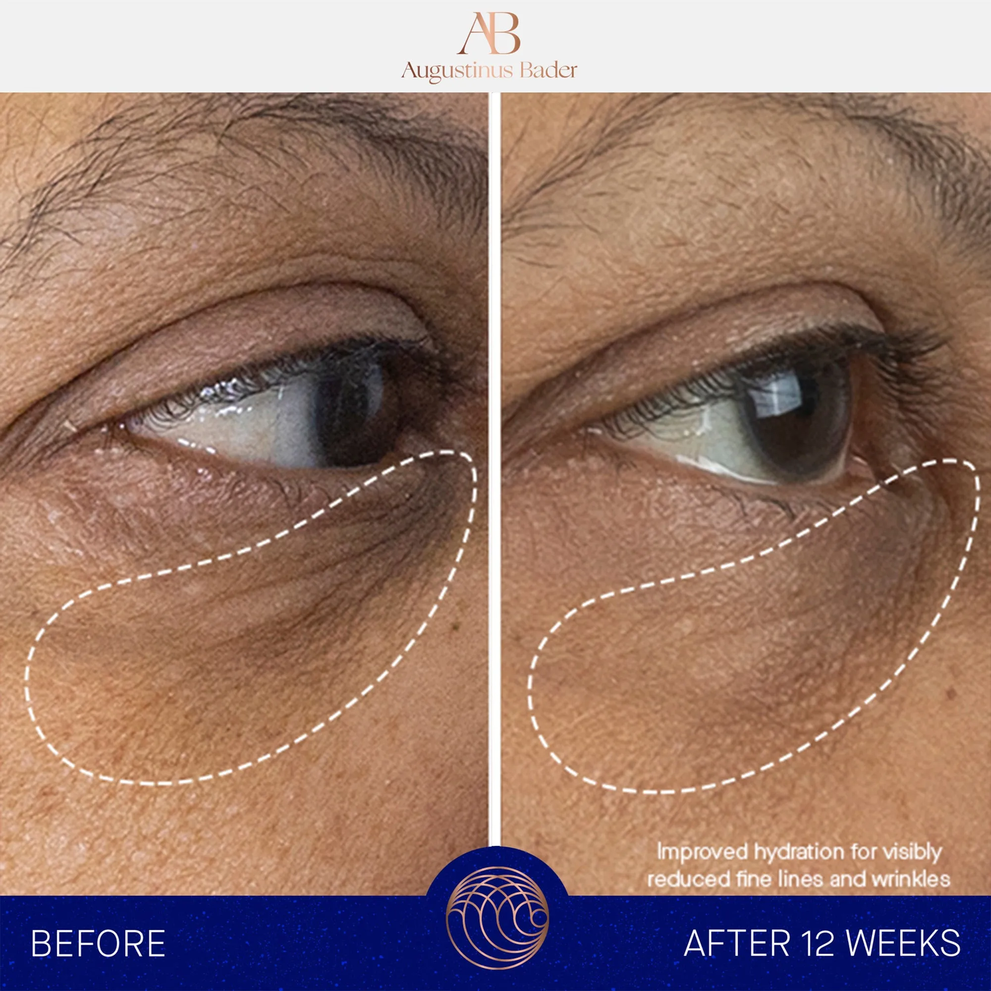 The Eye Cream -- Powered by TFC8® ** 15 ml