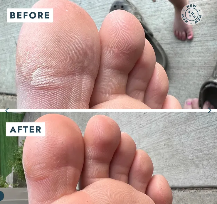 Voesh | Heel Repair Duo