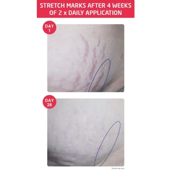 Weleda Stretch Mark Body Butter